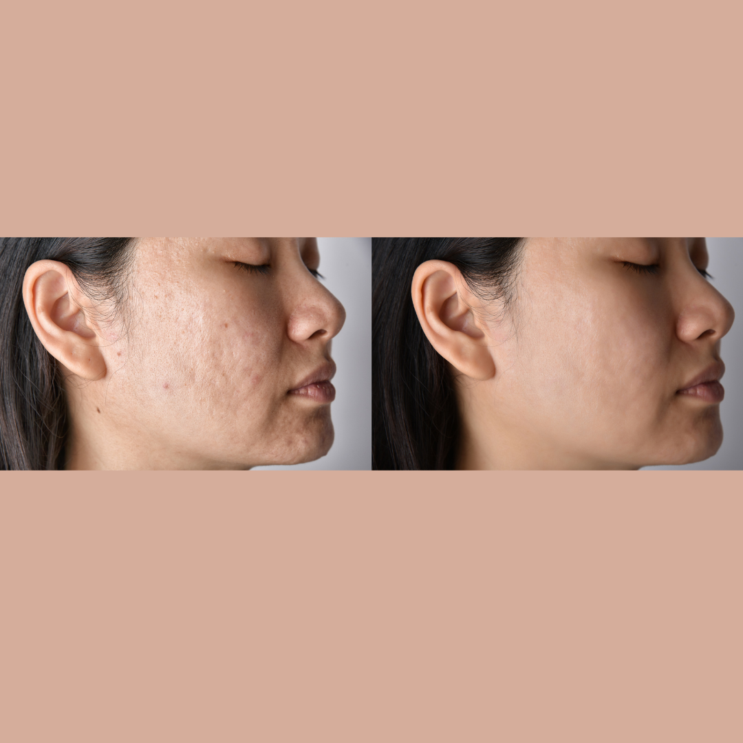 Savon PuretéGiroflée AZAELY pour hydrater et nourrir les peaux séches