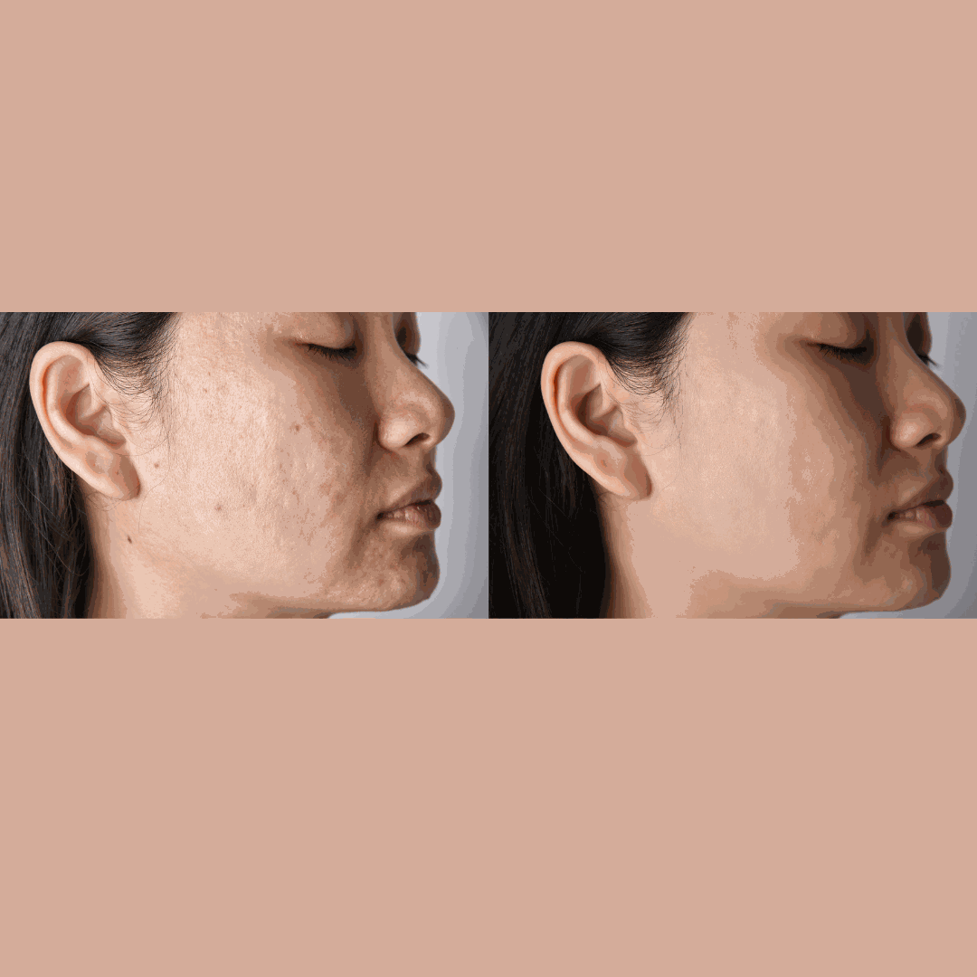 Savon Pureté Giroflée AZAELY pour hydrater et nourrir les peaux séches