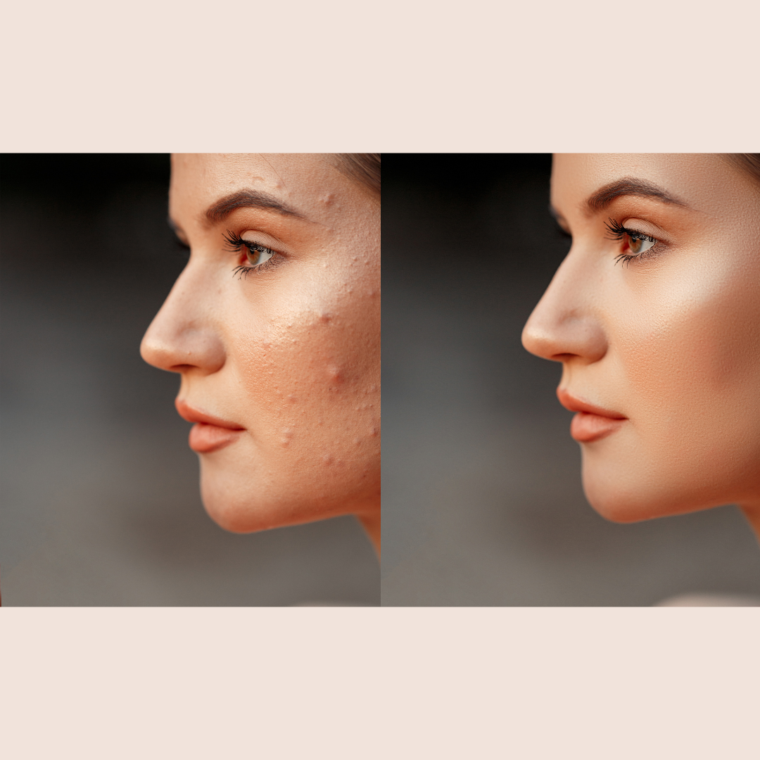 Savon (DouceurSoufre) AZAELY pour tous les peaux grasses et mixte