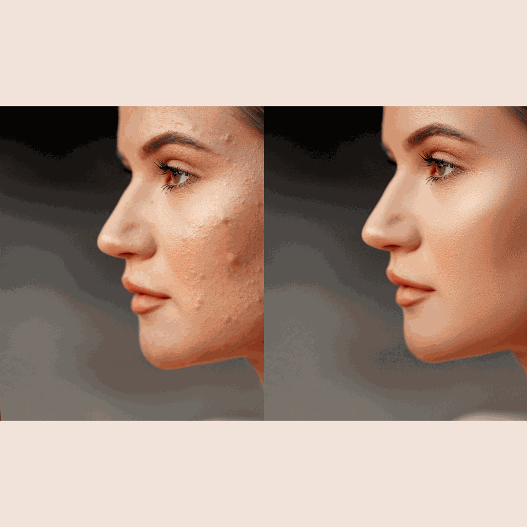 Savon DouceurSoufre AZAELY pour cheveux gras ou peau grasse