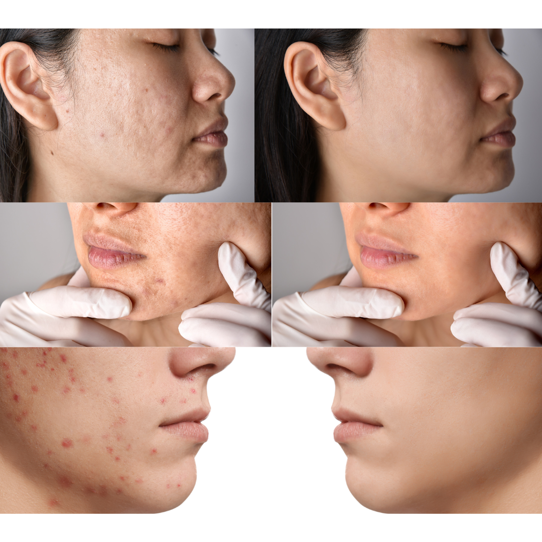 Kit (TrioSoin) : pour une peau sans imperfections