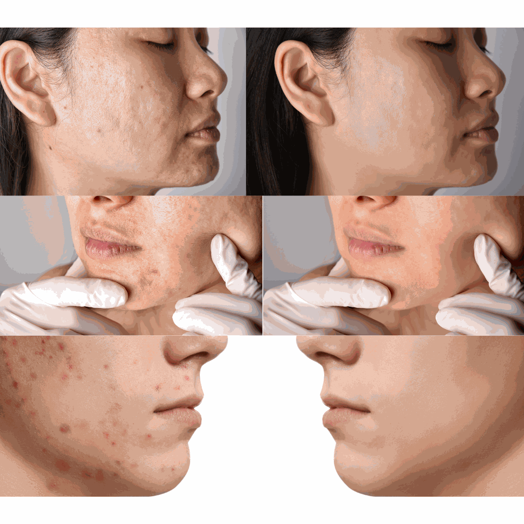 Kit Trio Harmonie (TrioSoin) : pour une peau sans imperfections