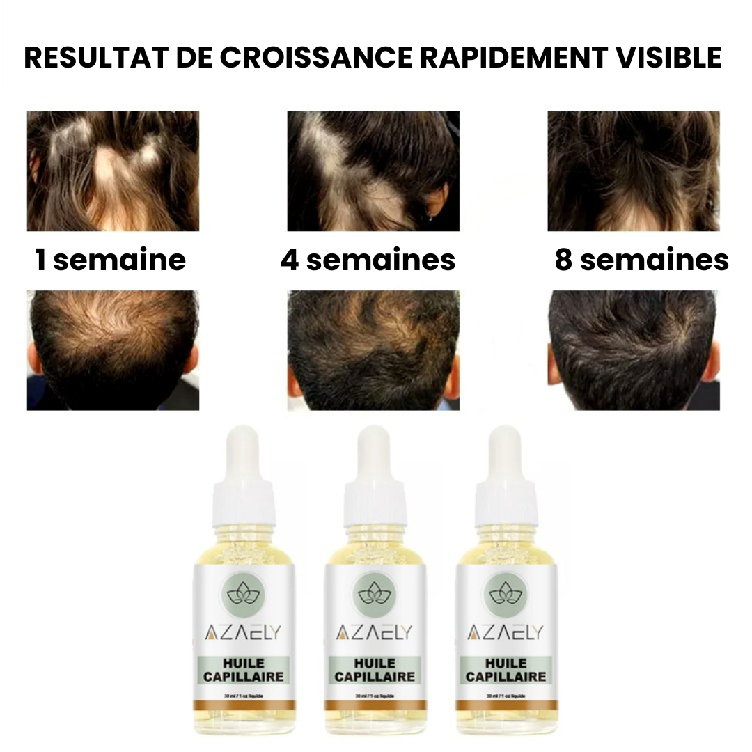 Huile capillaire (AZAELY) pour cheveux des cheveux éclatants