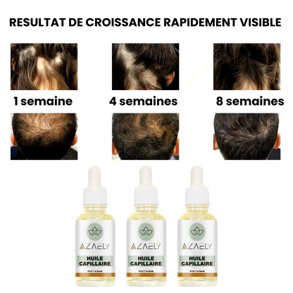 Huile capillaire (AZAELY) pour cheveux des cheveux éclatants