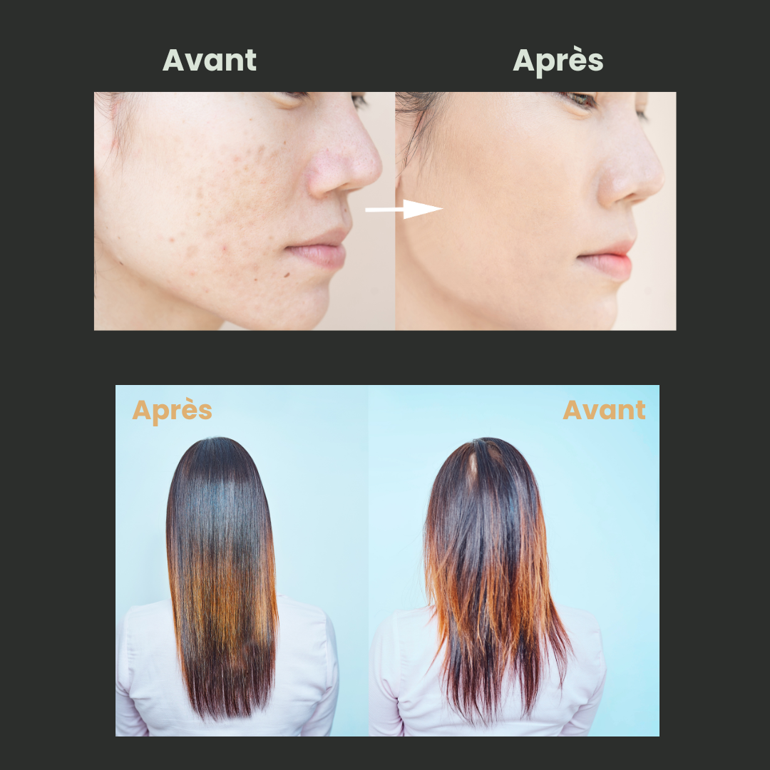 Le baume hydratant (Hydra-Mousse) AZAELY pour peau séche et cheveux secs
